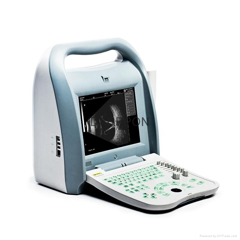 Full Digital Ophthalmic A/B Ultrasound Scanner (ODU8) 3