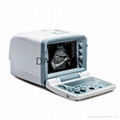 Medica Equipment Portable B/W Ultrasound Scanner (KX2000G)