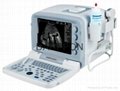 Medica Equipment Portable B/W Ultrasound Scanner (KX2000G) 2