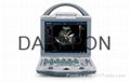 Medical Equipment Portable Color Doppler Ultrasound Scanner for Human (DCU12)