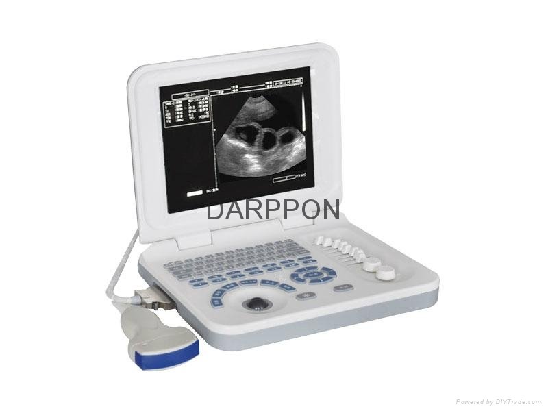 Pl-3018 Veterinary Laptop Ultrasound Scanner 2