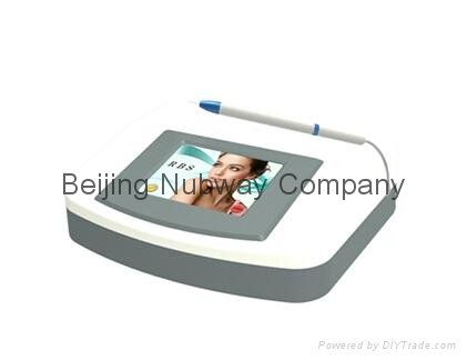 30Mhz high frequency painless spider vein removal machine 2