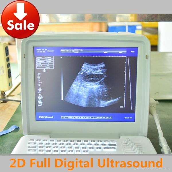 12inch LED Portable Human Ultrasound Scanner