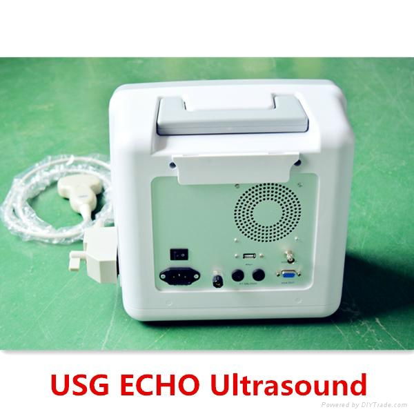 12inch LED Portable Human Ultrasound Scanner 2
