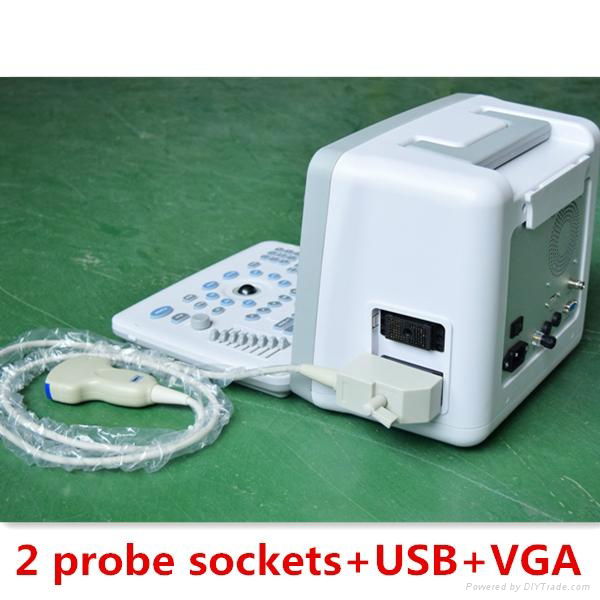 12inch LED Portable Human Ultrasound Scanner 4