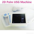 Human Palm 2D Ultrasound Scanner with