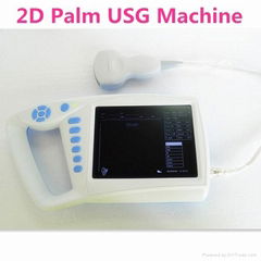 Human Palm 2D Ultrasound Scanner with built-in battery