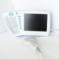 VET Palm Ultrasound Scanner with built-in battery 3