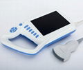 VET Palm Ultrasound Scanner with built-in battery 5