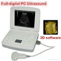 PC+3D Notebook Ultrasound Scanner with 18-month warranty