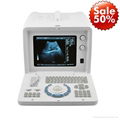 10inch CRT Portable Ultrasound Scanner 1