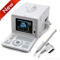 10inch CRT Portable Ultrasound Scanner 2
