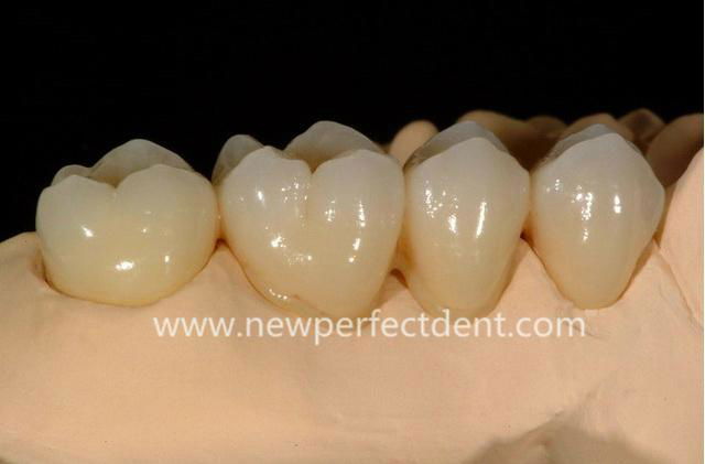 China dental lab Zirconia 2