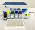 人天冬氨酸轉氨酸（AST)ELISA Kit 2