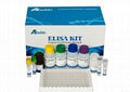 Human Aspartate aminotransferase (AST) ELISA Kit 4