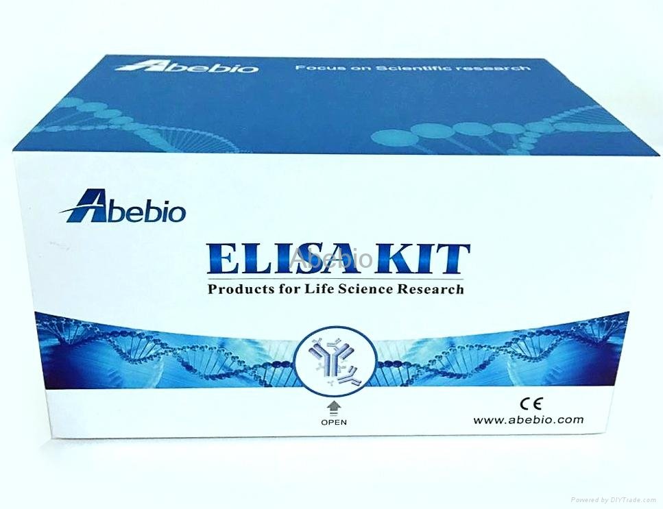 Human Aspartate aminotransferase (AST) ELISA Kit