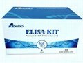 Human Aspartate aminotransferase (AST) ELISA Kit