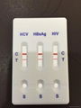 Hepatitis B Virus Surface Antigen HBsAg Tests strip  5