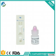 Tuberculosis TB Rapid Test Kits