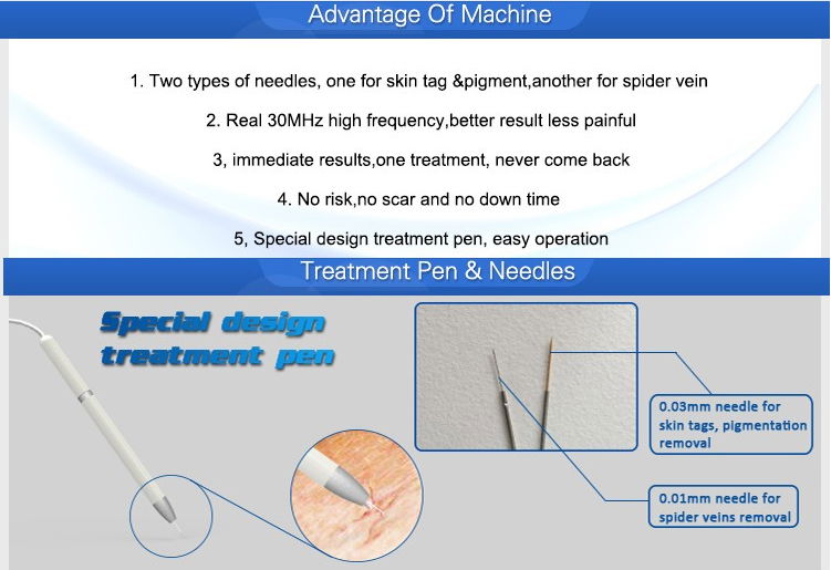 Immediately result 30MHz RBS vascular lesions pigmentation removal facial care b 3