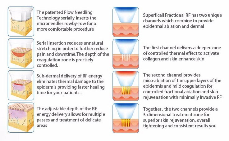 Fractional infini rf stretch mark radio frequency micro needle machine mesothera 5