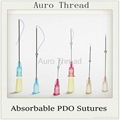 PDO Thread lifting 1