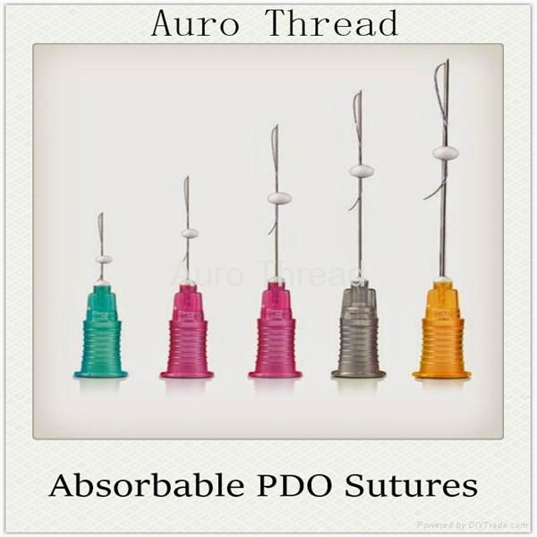 PDO Thread facelifting 5