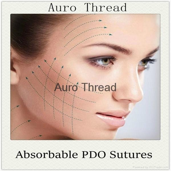 Absorbable Pdo Thread Lifting with Needle 5