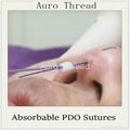 Re-shape nose 3D Cog PDO Thread with L needle/Blunt cannula for Nose Lift 4