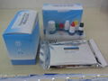  rapid test device blood group reagent hepatitis e virus elisa test kits