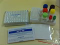 HAV rapid elisa reagent kit