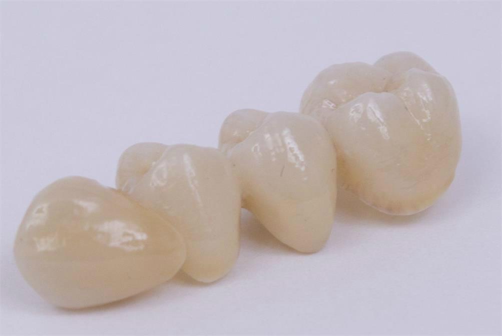 Dental porcelain teeth