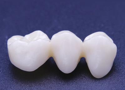 Dental porcelain teeth