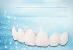 Dental porcelain teeth