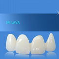 Dental porcelain teeth