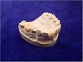 Dental Zirconia Porcelain