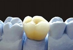Dental Alloy Ceramic teeth