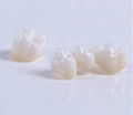 dental porcelain teeth