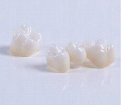 dental porcelain teeth 