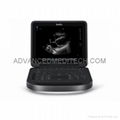 NEW SONOSITE EDGE II - ULTRASOUND SYSTEM