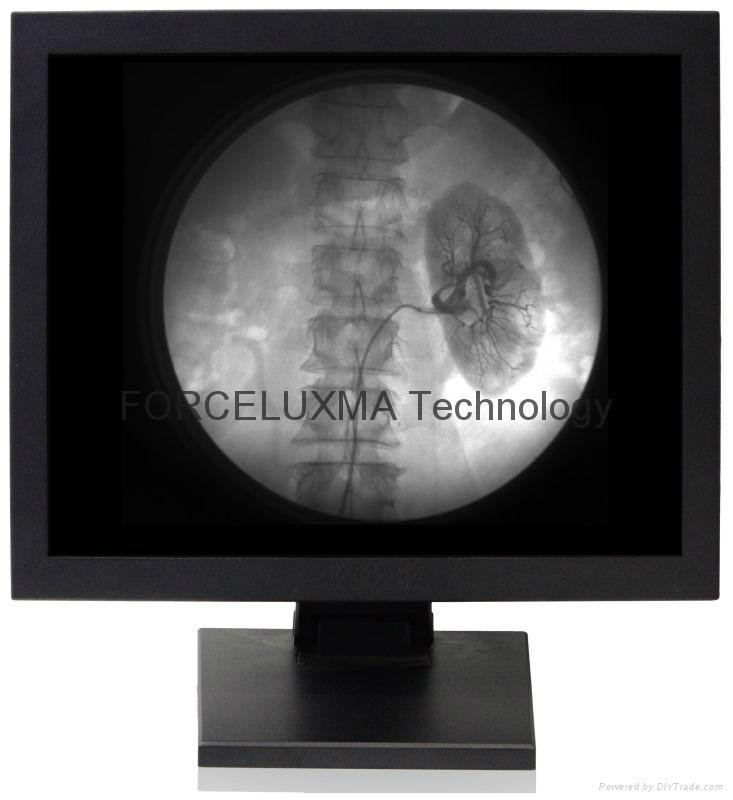 17 inch Medical Diagnostic High Bright Desktop Display