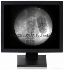 17 inch Medical Diagnostic High Bright