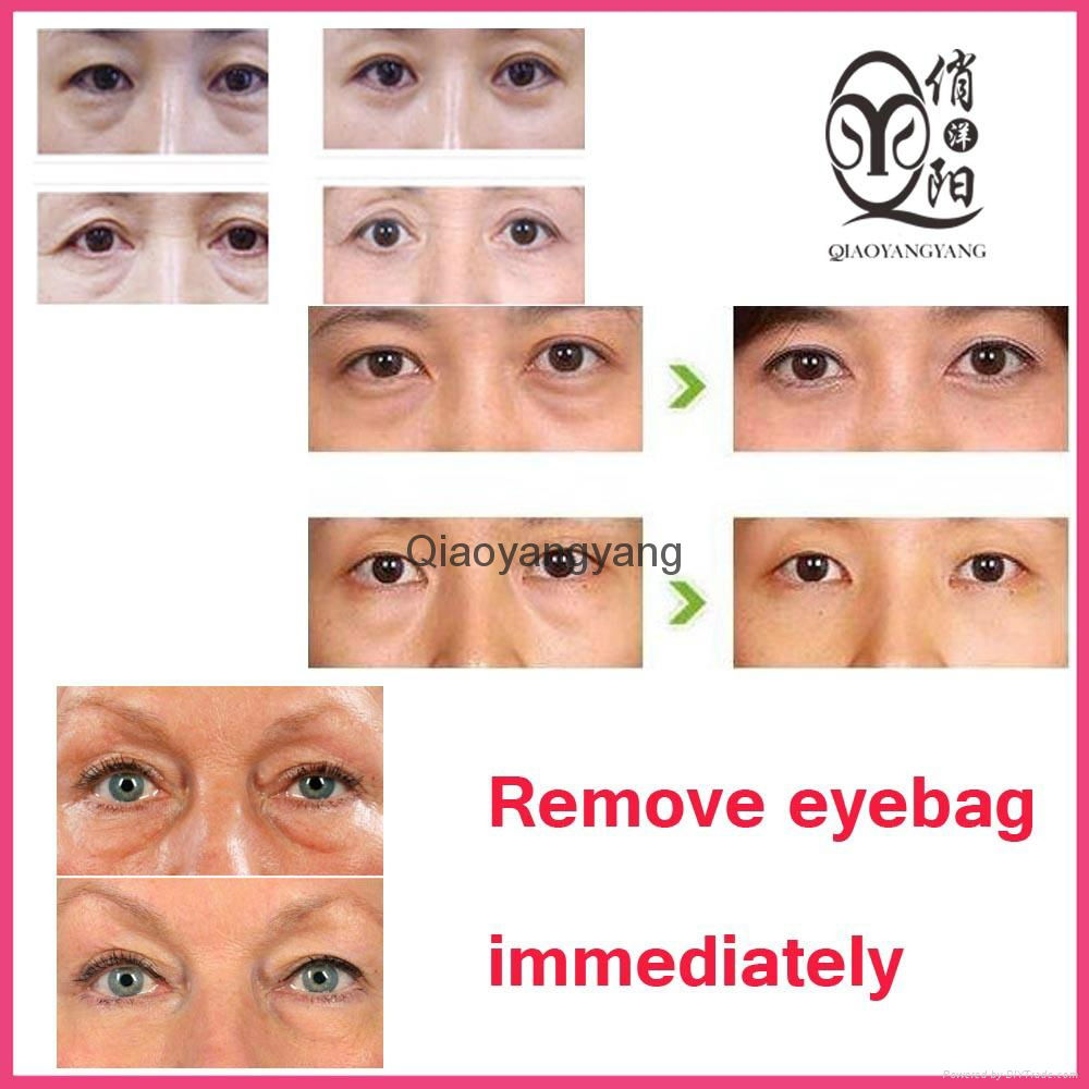 oem eye bag remover cream immediately 3