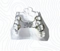 Dental Orthodontic Appliances 1