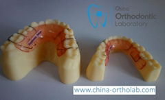 Dental Orthodontic Appliances