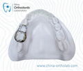 Dental Orthodontic Appliances 7