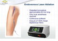 Laser Leg Vein Treatment Endovascular