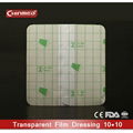 surgical disposable Transparent PU wound dressing 2