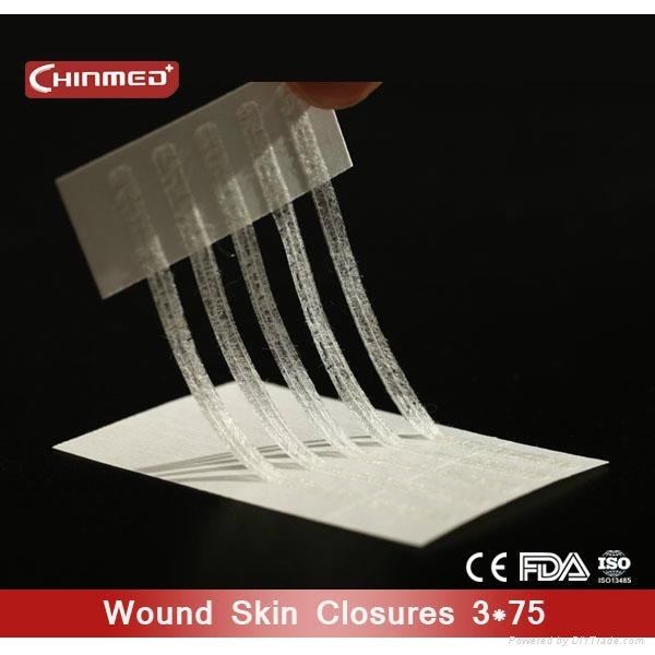 disposable surgical Wound skin closure 1