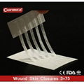 disposable surgical Wound skin closure